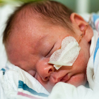 Premature baby boy sleeping with a feeding tube in his nose.