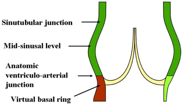 FreeMarginsAdjacentLeaflets